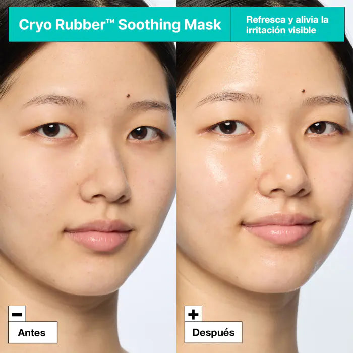 Cryo Rubber with Soothing Allantoin Mask